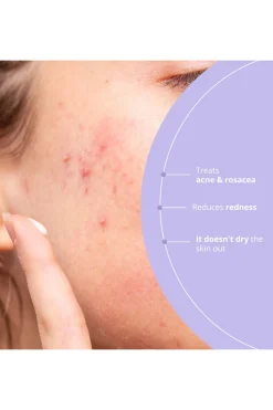 Freshly Cosmetics Azelaic Radiance blanco Clearance