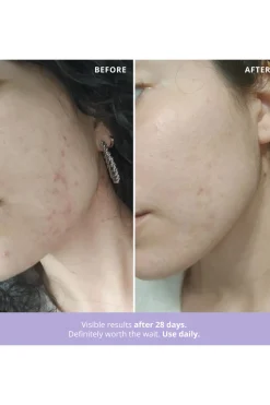 Freshly Cosmetics Azelaic Radiance blanco Clearance